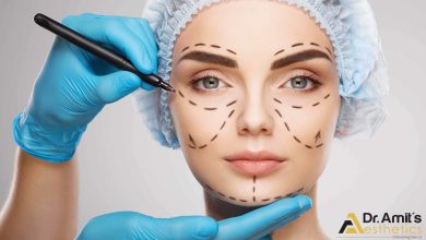 Cosmetic Surgeon in Siliguri