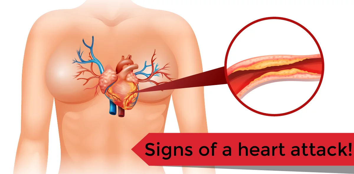 Sign Heart Attack