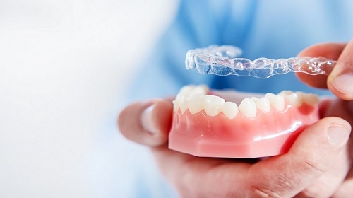 Invisalign London